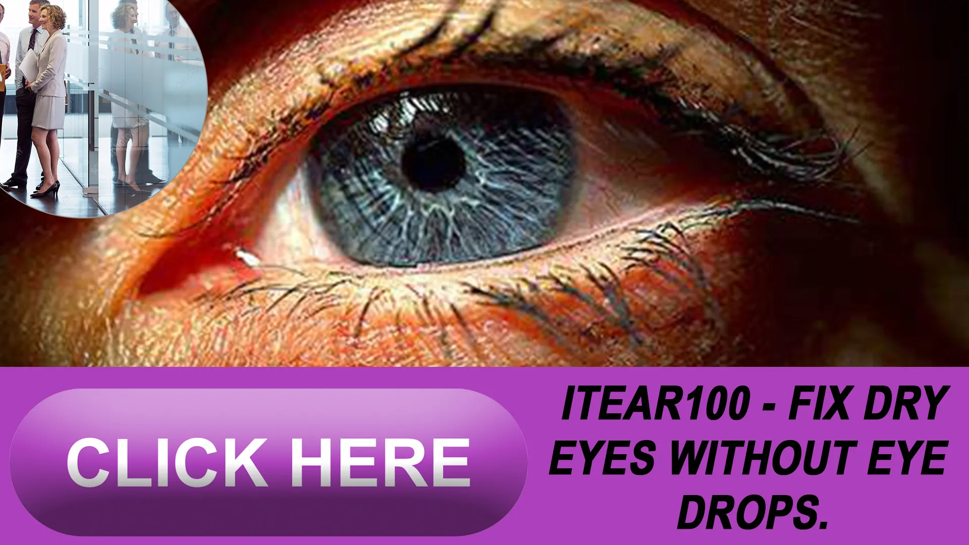 Tackling Dry Eye Syndrome with Revolutionary Technology