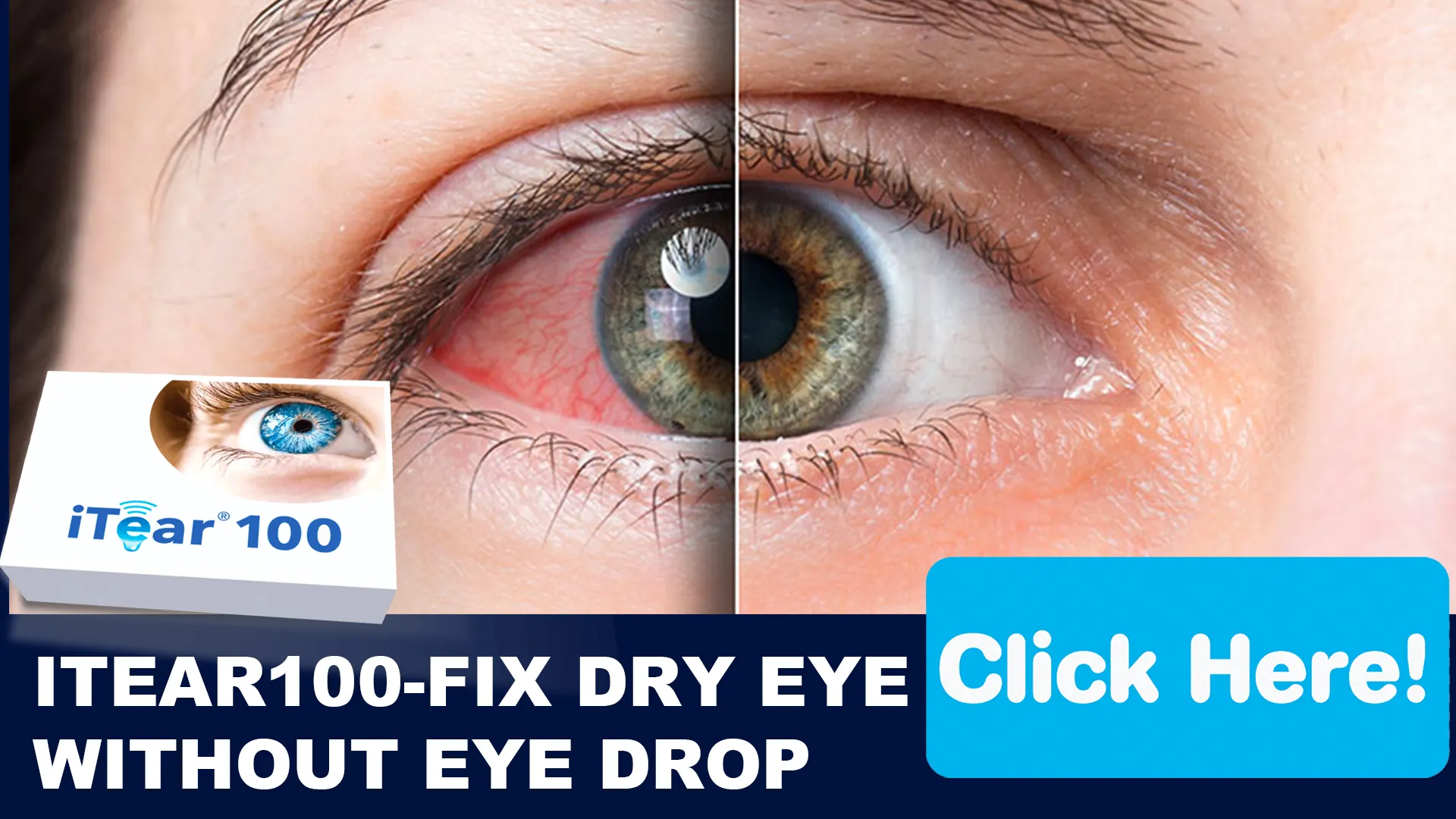 Why iTEAR100 Is a Revolutionary Solution for Dry Eyes
